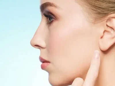 Protruding Ear Surgery